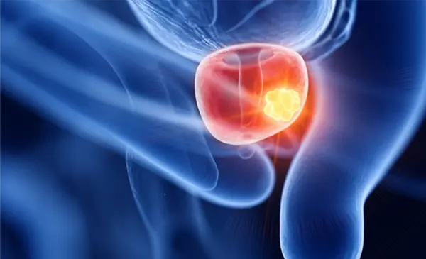 Explore more Prostate Cancer Resources