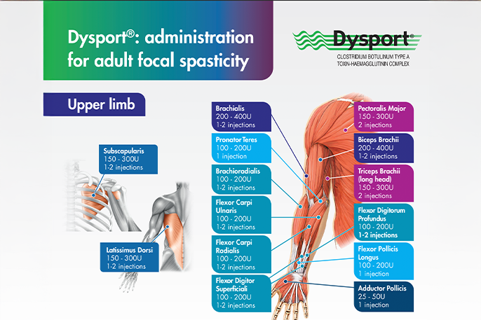 Dysport<sup>®</sup> administration guide for adult focal spasticity affecting the upper limbs