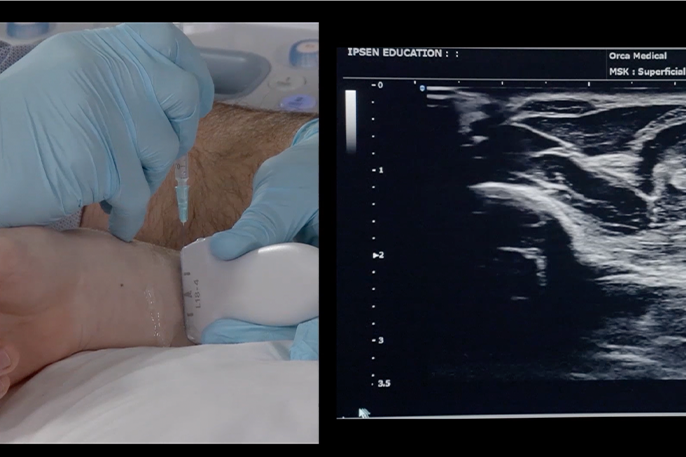 AS US Essentials Injection of the Hand