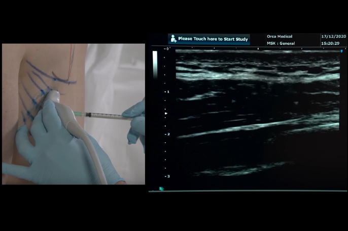 AS US Essentials Injection of the Shoulder